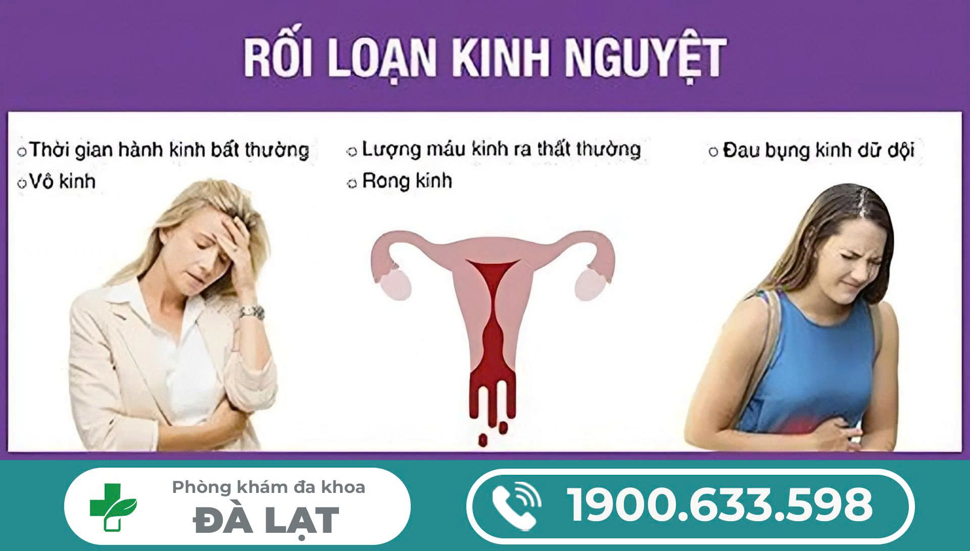 Hình ảnh minh họa